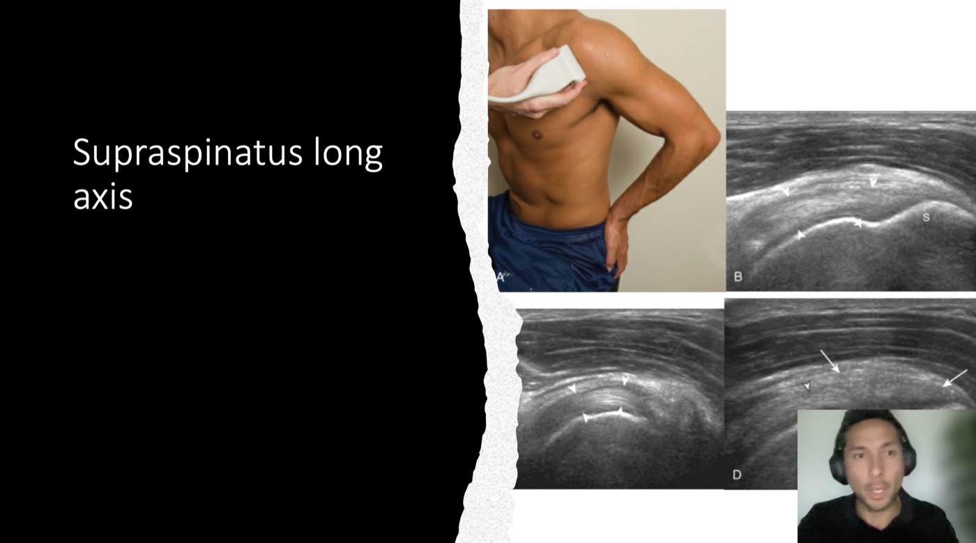Pura Health online teaching: Carlos explaining shoulder anatomy and ultrasound images