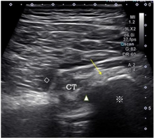 Question 1 reference image, with original annotations preserved.